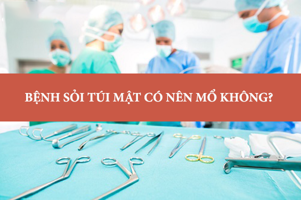 Bị bệnh sỏi túi mật có nên mổ không