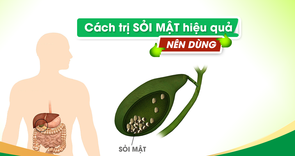 Khi bị sỏi mật cần phải làm gì?